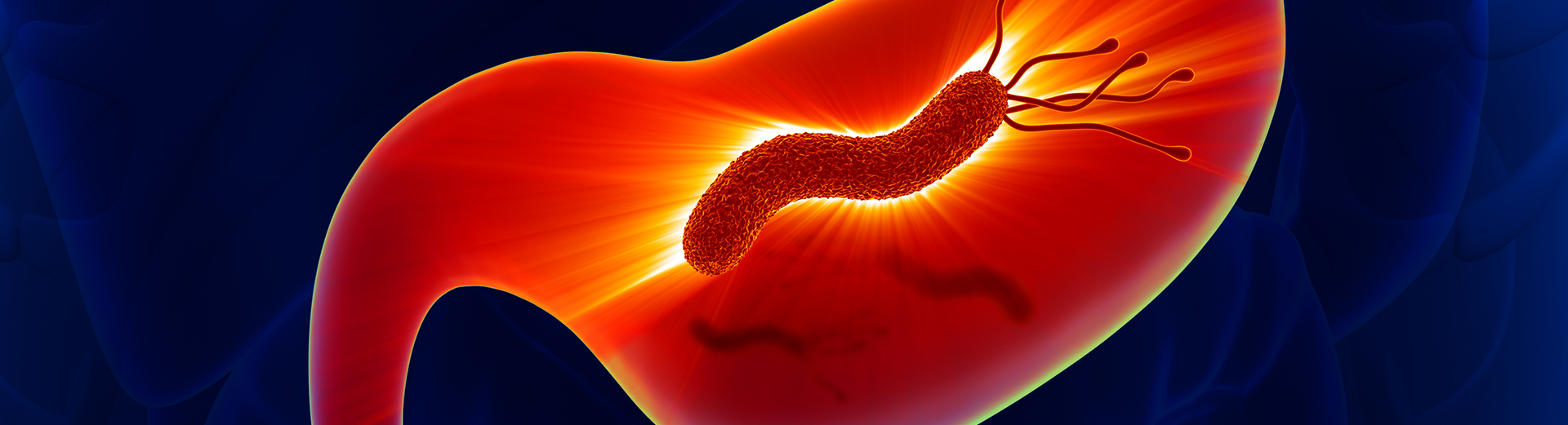 Helicobacter pylori, una bacteria en el estómago
