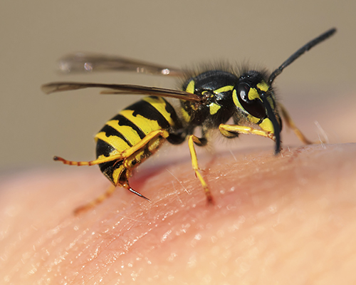 Otra de las causas de anafilaxia es la picadura de avispas y abejas